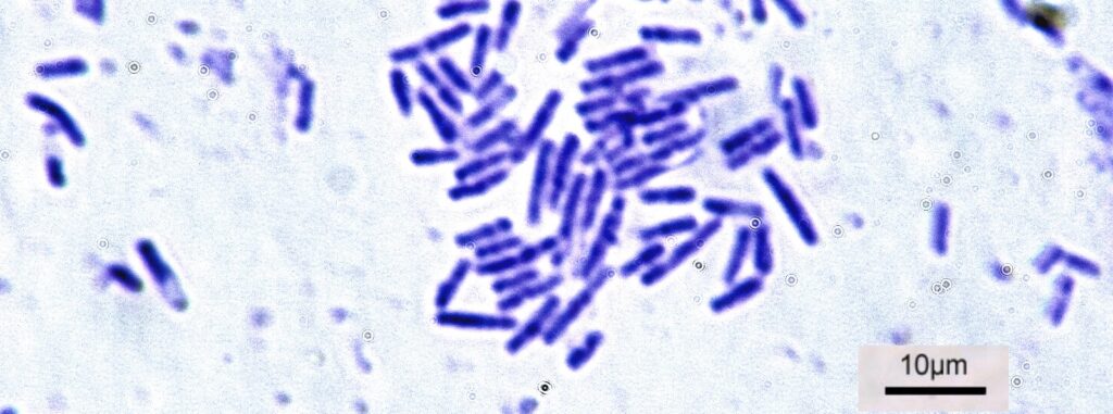 Bacillus bacteria
