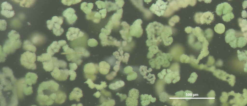 Microscopic image of algae
